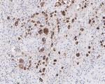 CD30 Antibody in Immunohistochemistry (Paraffin) (IHC (P))