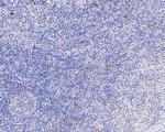 CD30 Antibody in Immunohistochemistry (Paraffin) (IHC (P))