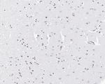 SRF Antibody in Immunohistochemistry (Paraffin) (IHC (P))