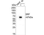 SRF Antibody in Immunoprecipitation (IP)
