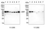 SRF Antibody in Western Blot (WB)
