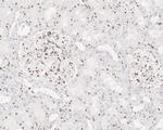 NCOA4 Antibody in Immunohistochemistry (Paraffin) (IHC (P))
