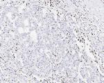 NCOA4 Antibody in Immunohistochemistry (Paraffin) (IHC (P))