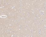 TrkC Antibody in Immunohistochemistry (Paraffin) (IHC (P))