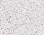 TrkC Antibody in Immunohistochemistry (Paraffin) (IHC (P))