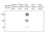 H3K9ac Antibody in Dot Blot (DB)