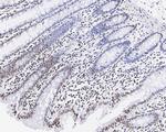 H3K27me3 Antibody in Immunohistochemistry (Paraffin) (IHC (P))