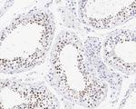 POLL Recombinant Rabbit Monoclonal Antibody (PSH05-24)