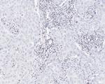 SMCHD1 Antibody in Immunohistochemistry (Paraffin) (IHC (P))