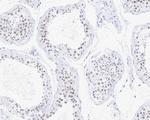 SMCHD1 Antibody in Immunohistochemistry (Paraffin) (IHC (P))