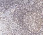 SMCHD1 Antibody in Immunohistochemistry (Paraffin) (IHC (P))