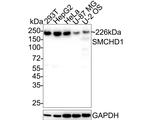 SMCHD1 Antibody in Western Blot (WB)