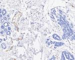 Complement C5 Antibody in Immunohistochemistry (Paraffin) (IHC (P))