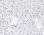 Complement C5 Antibody in Immunohistochemistry (Paraffin) (IHC (P))