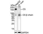Complement C5 Antibody in Western Blot (WB)