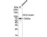 Complement C5 Antibody in Western Blot (WB)