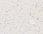 LNP Antibody in Immunohistochemistry (Paraffin) (IHC (P))