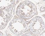 LNP Antibody in Immunohistochemistry (Paraffin) (IHC (P))
