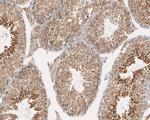 LNP Antibody in Immunohistochemistry (Paraffin) (IHC (P))