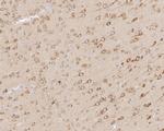 LNP Antibody in Immunohistochemistry (Paraffin) (IHC (P))