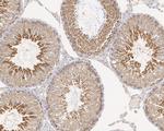 LNP Antibody in Immunohistochemistry (Paraffin) (IHC (P))