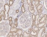 CPT1A Antibody in Immunohistochemistry (Paraffin) (IHC (P))