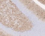CPT1A Antibody in Immunohistochemistry (Paraffin) (IHC (P))