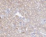 CPT1A Antibody in Immunohistochemistry (Paraffin) (IHC (P))