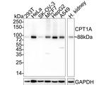 CPT1A Antibody in Western Blot (WB)