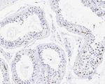 WEE1 Recombinant Rabbit Monoclonal Antibody (PSH05-11)