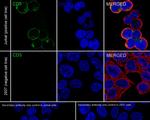 CD5 Antibody in Immunocytochemistry (ICC/IF)