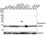 PSEN2 Recombinant Rabbit Monoclonal Antibody (PSH05-18)