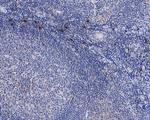 Caspase 8 Antibody in Immunohistochemistry (Paraffin) (IHC (P))