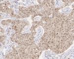 CK2 alpha-1 Antibody in Immunohistochemistry (Paraffin) (IHC (P))