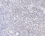CK2 alpha-1 Antibody in Immunohistochemistry (Paraffin) (IHC (P))