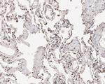 HDJ2 Antibody in Immunohistochemistry (Paraffin) (IHC (P))
