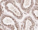 HDJ2 Antibody in Immunohistochemistry (Paraffin) (IHC (P))