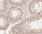 HDJ2 Antibody in Immunohistochemistry (Paraffin) (IHC (P))