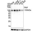 TRIF Recombinant Rabbit Monoclonal Antibody (PSH05-39)