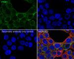 PKM1 Recombinant Rabbit Monoclonal Antibody (PSH04-37)