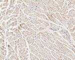 PKM1 Antibody in Immunohistochemistry (Paraffin) (IHC (P))