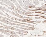 PKM1 Antibody in Immunohistochemistry (Paraffin) (IHC (P))