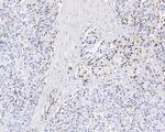 Apolipoprotein J Recombinant Rabbit Monoclonal Antibody (PSH04-33)