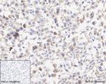 RIP3 Antibody in Immunohistochemistry (Paraffin) (IHC (P))
