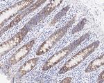 PABP Antibody in Immunohistochemistry (Paraffin) (IHC (P))