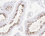 PABP Antibody in Immunohistochemistry (Paraffin) (IHC (P))