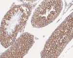 PABP Antibody in Immunohistochemistry (Paraffin) (IHC (P))