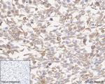 RIP3 Antibody in Immunohistochemistry (Paraffin) (IHC (P))