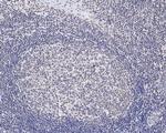 Pokemon Antibody in Immunohistochemistry (Paraffin) (IHC (P))