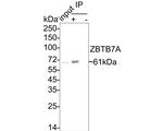 Pokemon Antibody in Immunoprecipitation (IP)